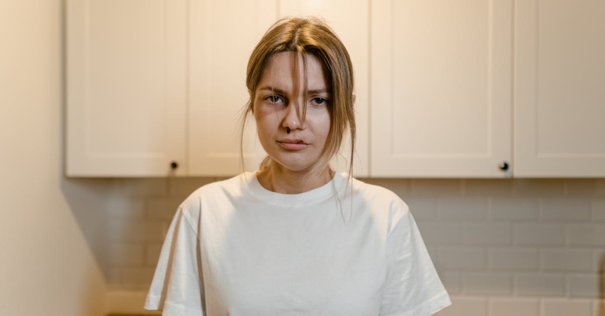 What evidence do you need for a personal injury claim?