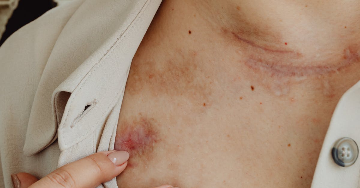 What not to say to an injury lawyer?